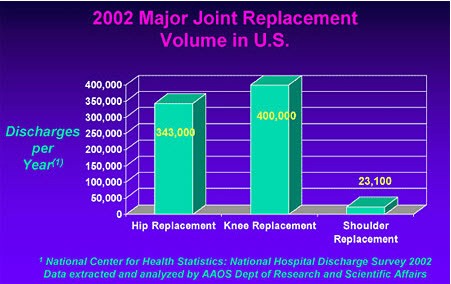 Major joint replacement volume in US